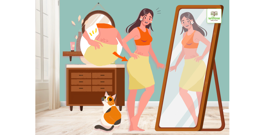 Berapa Lama Stretch Mark Bisa Hilang?